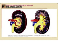 Рельефная таблица "Почка. Фронтальный разрез" (формат А1, матовое ламинирование) - fgospostavki.ru - Тихорецк