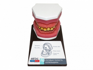 Демонстрационная модель "Ротовая полость курильщика" - fgospostavki.ru - Тихорецк