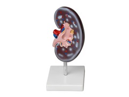 Модель почки в разрезе - fgospostavki.ru - Тихорецк